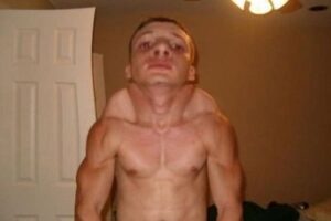 csuklyas
